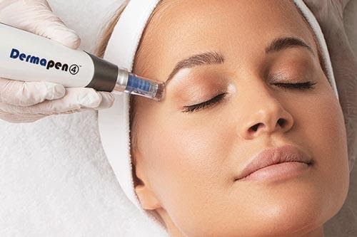 Tratamiento-dermapen